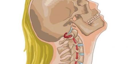 عادة
      شائعة
      في
      صالونات
      التجميل
      تسبب
      الإصابة
      بالسكتة
      الدماغية..
      احذرها - ستاد العرب