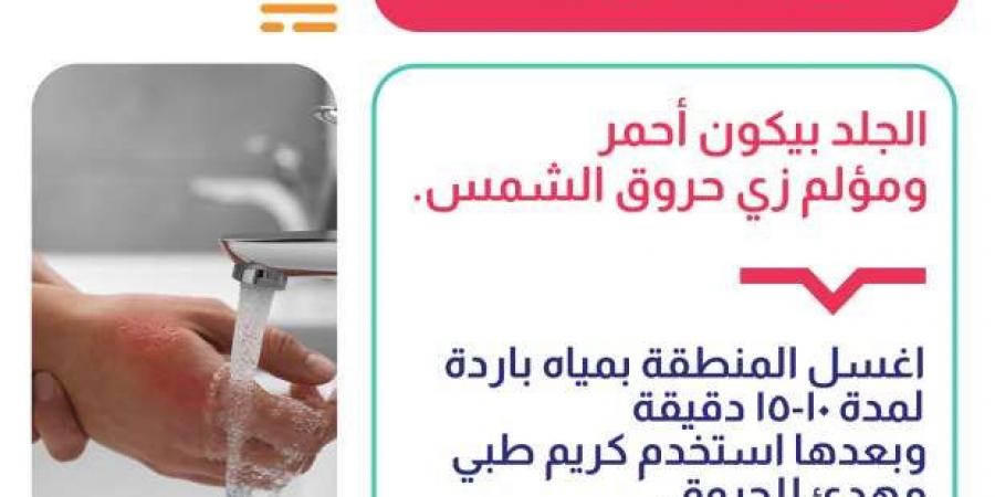 خطوات
      بسيطة
      تخفف
      من
      إصابات
      الحروق..
      «احذر
      استخدام
      البن
      أو
      معجون
      الأسنان» - ستاد العرب