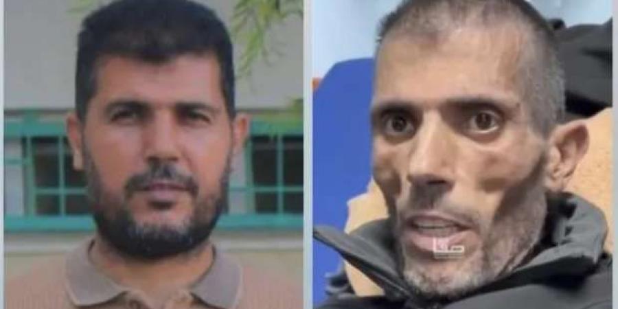 «بقى
      هيكل
      عظمي»..
      صور
      لفلسطيني
      قبل
      وبعد
      الإفراج
      عنه
      من
      سجون
      إسرائيل:
      تعذيب
      لا
      يوصف - ستاد العرب